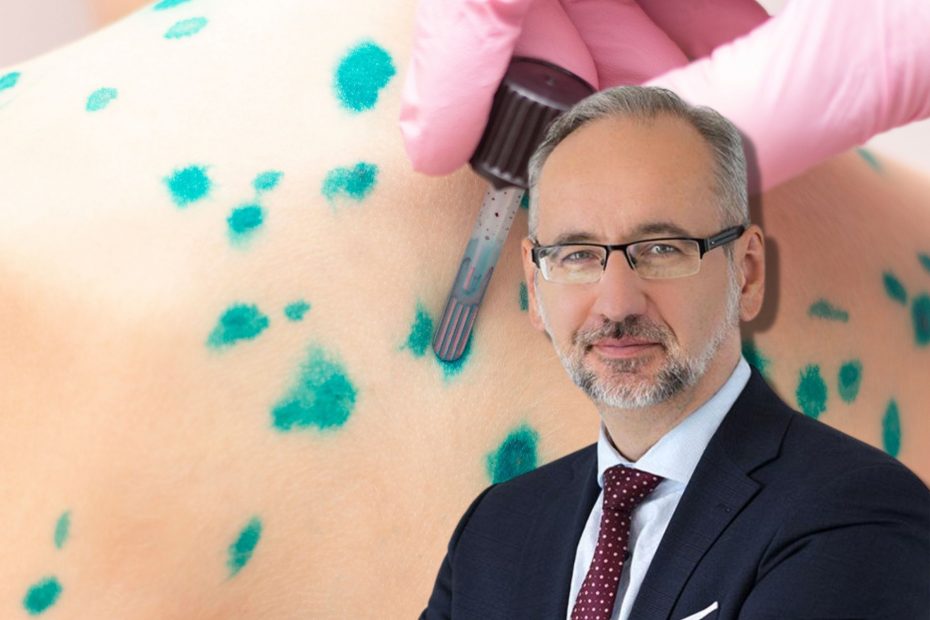 Nowe przypadki małpiej ospy